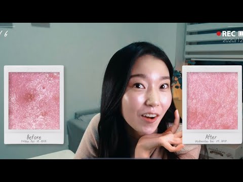 ミラクルダイヤモンドピーリング5日間プログラム - YouTube