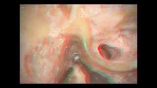 中耳・側頭骨3D解剖マニュアル[DVD-ROM付] | 書籍詳細 | 書籍 | 医学書院