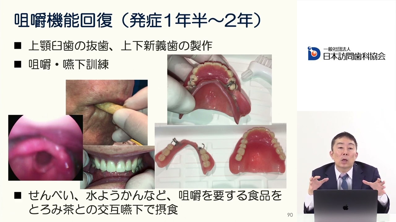 おいしく食べるための義歯・ケア・リハ – 株式会社デジタルクリエイト