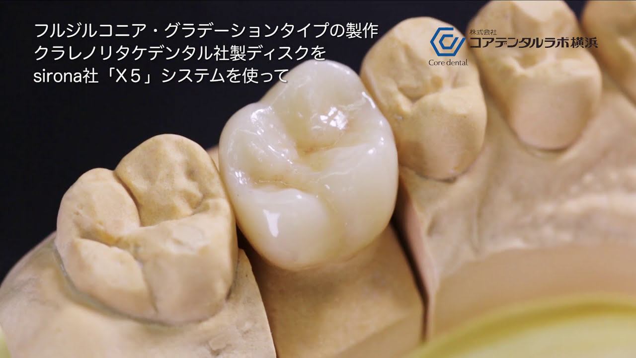 フルジルコニアクラウン・グラデーションディスクの加工から製作工程