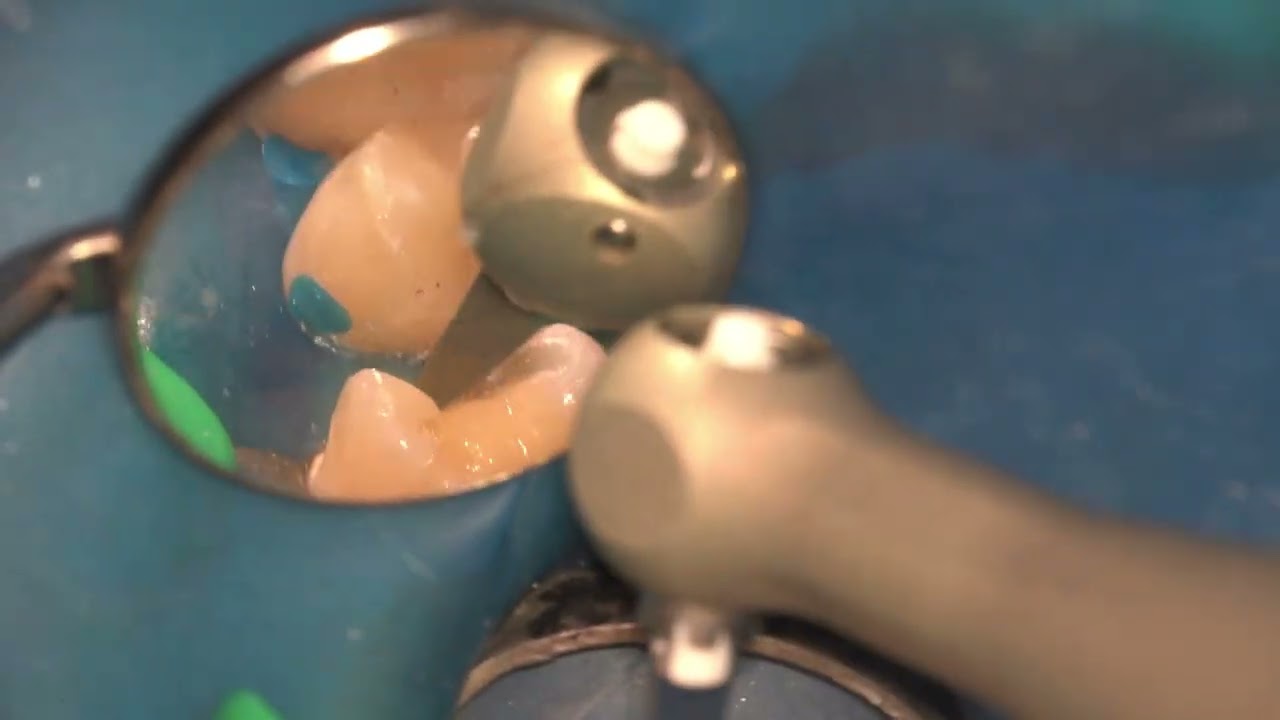 プロフィンPDXハンドピース（マイクロ/スタンダード） - 東京歯科産業