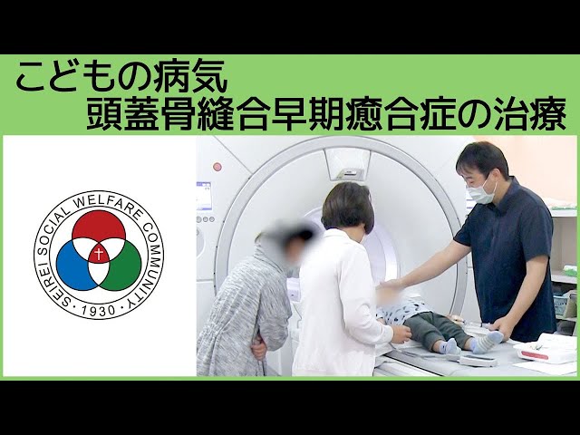 小児脳神経科」こどもの病気 頭蓋骨縫合早期癒合症の治療（白いまどNo