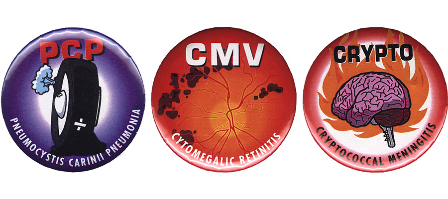 June 5, 1981—The First Report of AIDS in the U.S. – Circulating