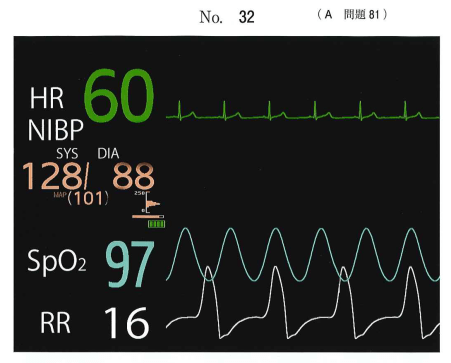 歯科麻酔学：局所麻酔薬中毒（計6問）【歯科医師国家試験】（2025年11
