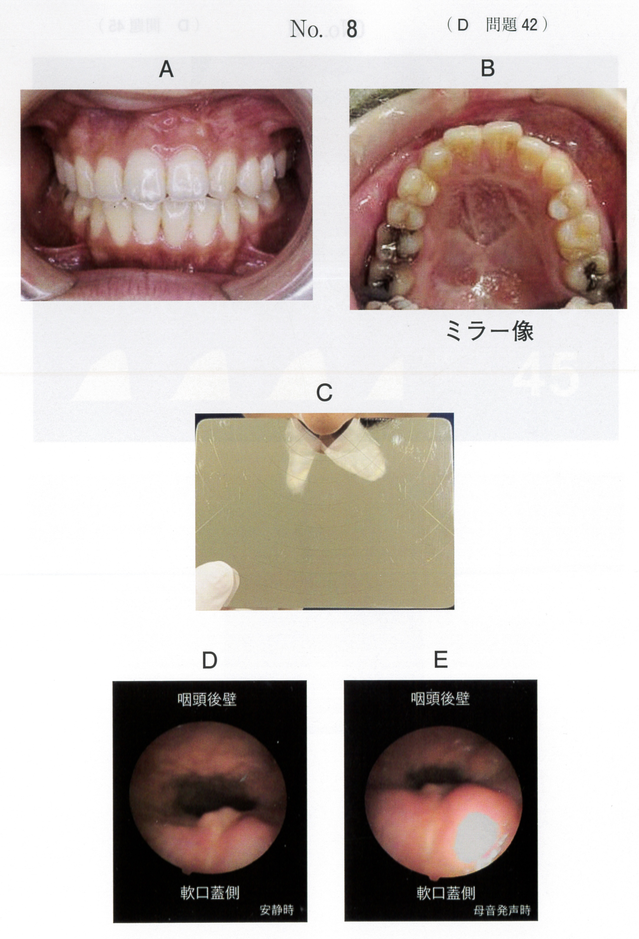 第119回 歯科医師国家試験 D問題 （2026年2月6日更新） | DENTAL YOUTH