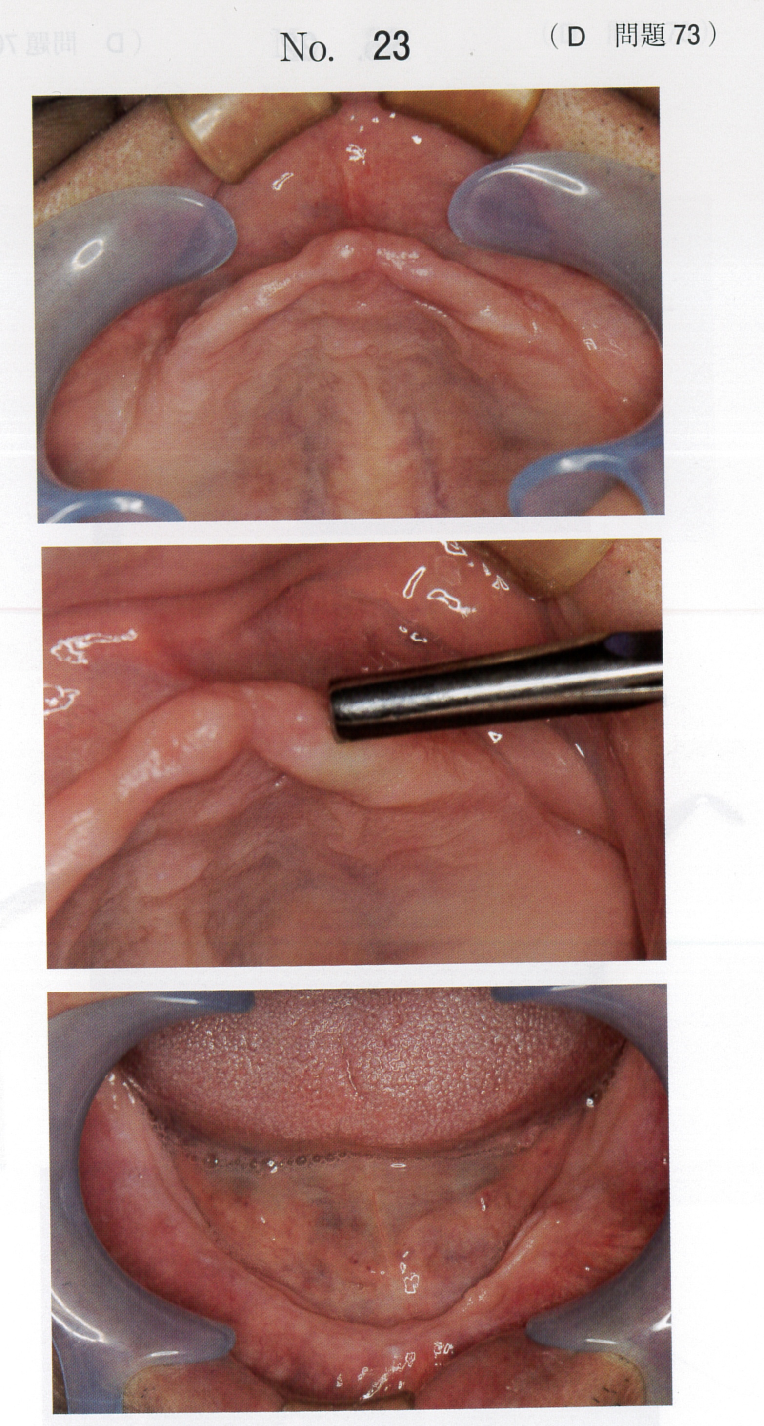 第119回 歯科医師国家試験 D問題 （2026年2月6日更新） | DENTAL YOUTH