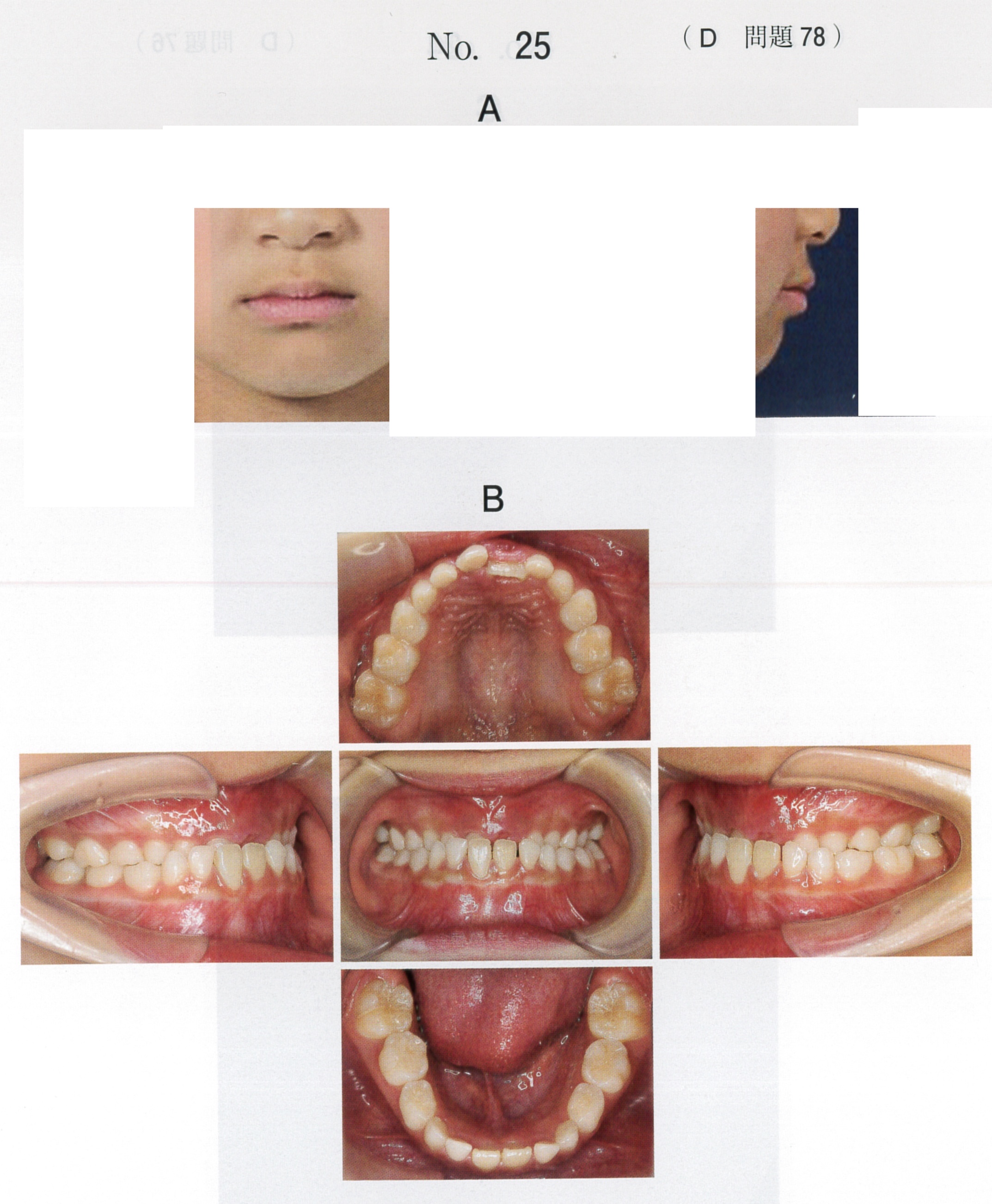 第119回 歯科医師国家試験 D問題 （2026年2月6日更新） | DENTAL YOUTH