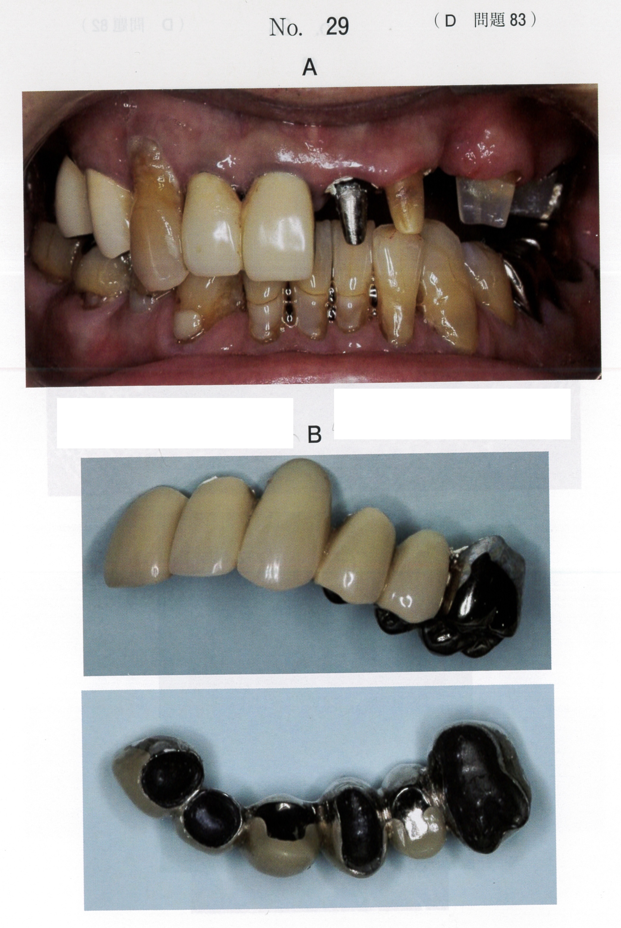 第119回 歯科医師国家試験 D問題 （2026年2月6日更新） | DENTAL YOUTH