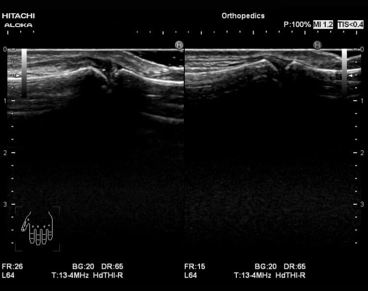 shinnkinnkennsonnshou-