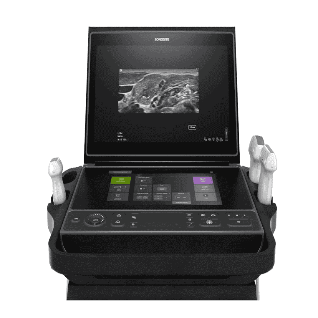 SonoSite ZX Ultrasound System - Mindtrack Healthcare