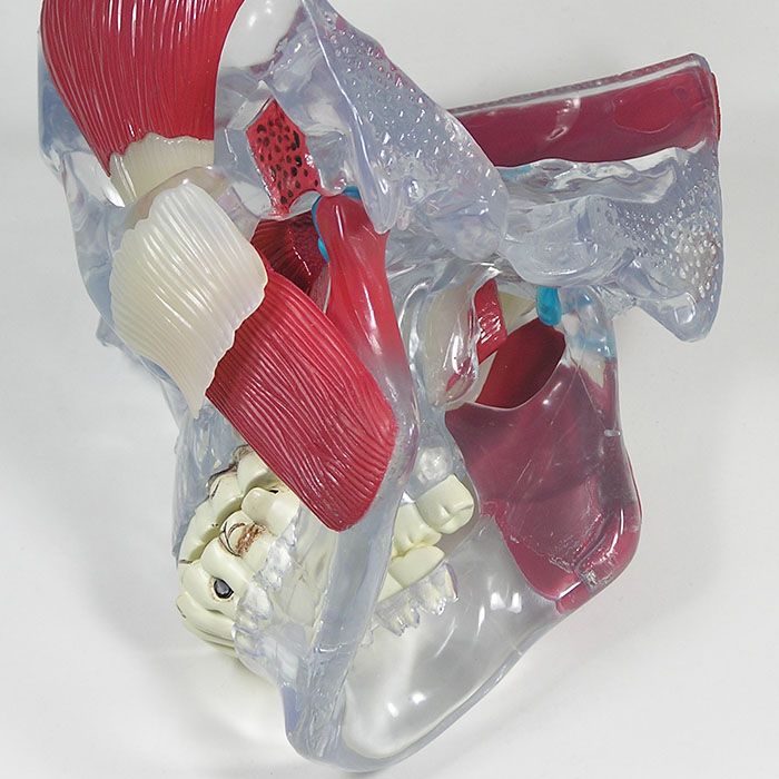 医学模型 顎関節障害