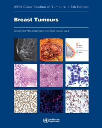 IARC Publications Website - Breast Tumours