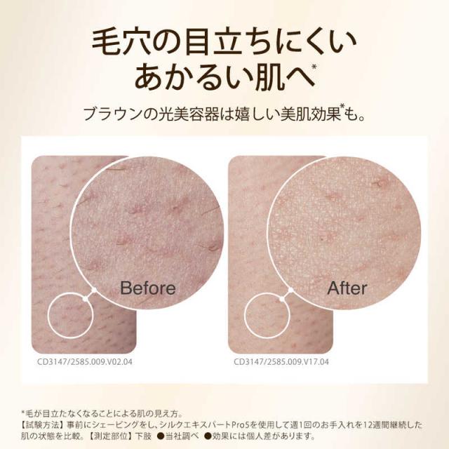 ブラウン BRAUN 家庭用光美容器 シルクエキスパートPro5 IPL方式 VIO