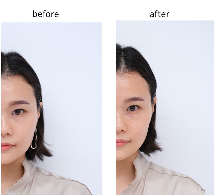 頑張らない「顔の筋トレ美顔器」の1週間ビフォーアフター | VERY