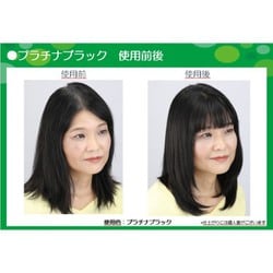 ヨドバシ.com - シラガレスキュー SIRAGA R9 シラガR9(シラガ