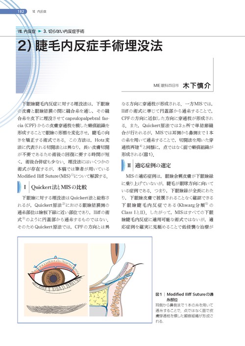 処置室でできる 低侵襲・眼瞼診療 切らない眼科医のアプローチ (新篇