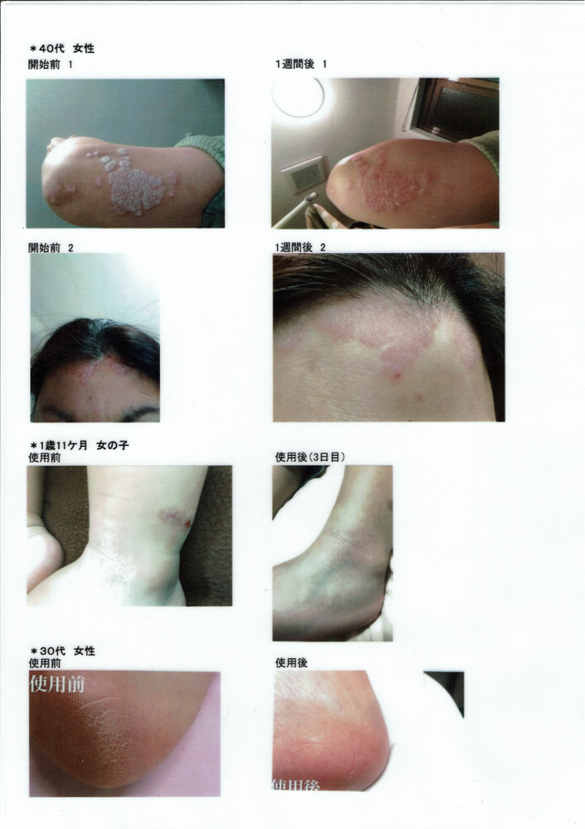 PharmaS1（皮膚トラブルに最適なシコニンクリーム【はな薬局オンライン