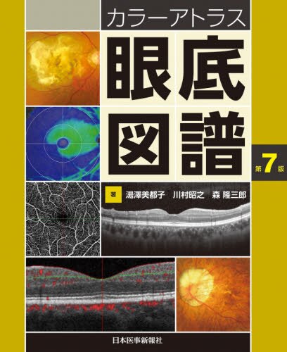 カラーアトラス眼底図譜 第7版 | 神陵文庫