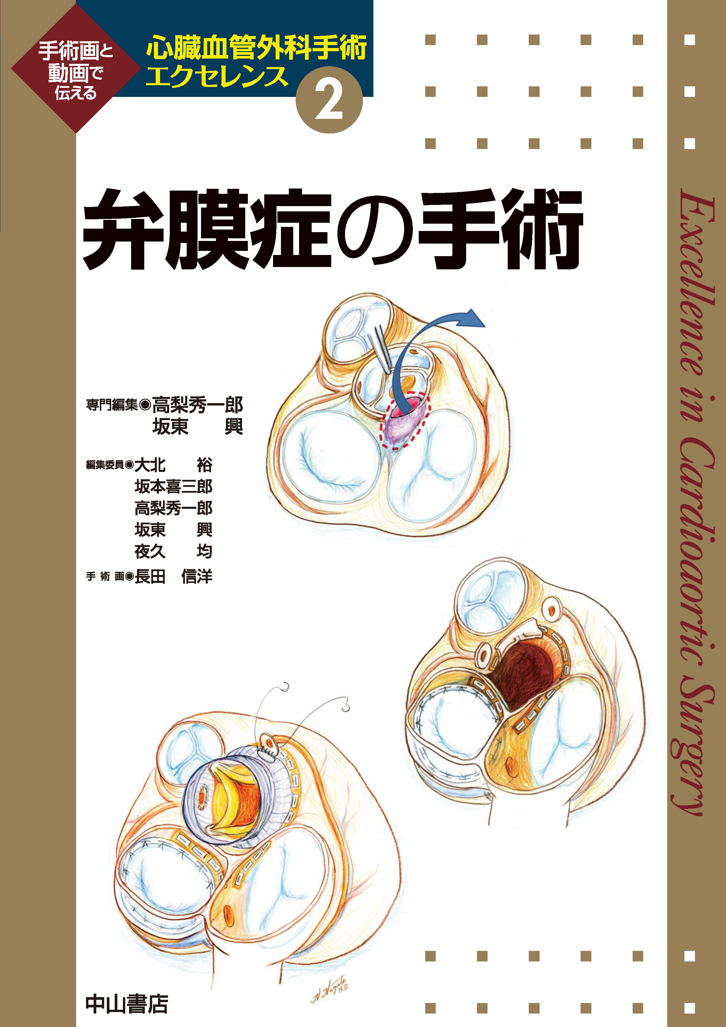 心臓血管外科手術エクセレンス 2 弁膜症の手術 | 神陵文庫