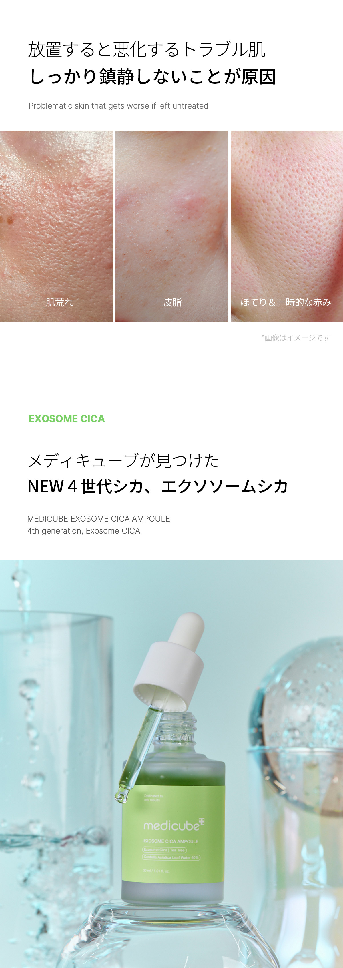楽天市場】【公式正品】エクソソームシカアンプル 30ml（メディ