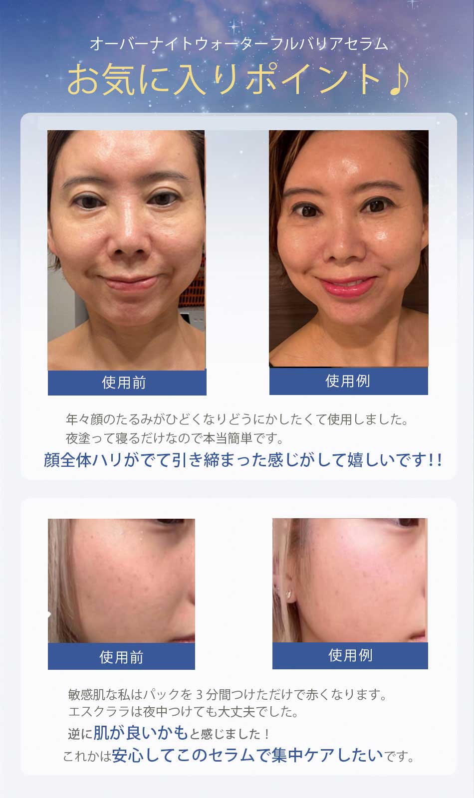 楽天市場】Sクララ S CLARA オーバーナイトウォーターフル