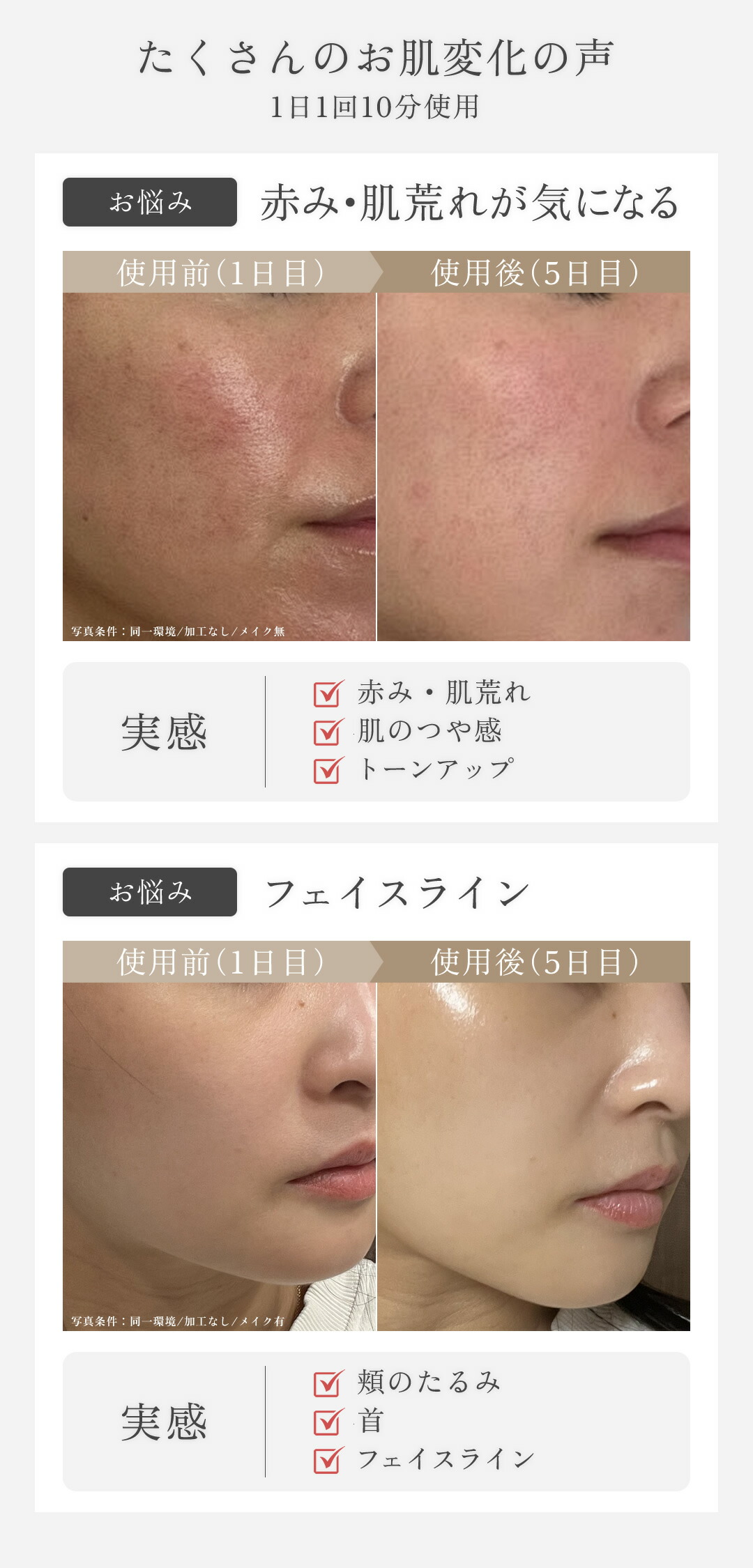 楽天市場】【5,000円OFF&ポイント10倍 3/1〜3/2】可変式RF×可変式EMS×3