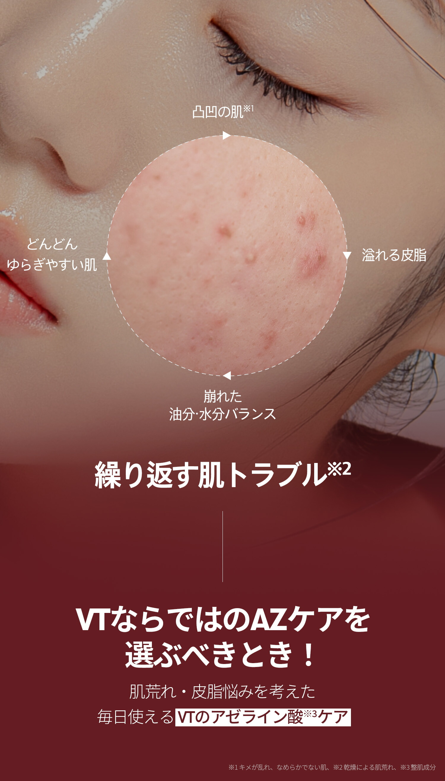 楽天市場】【VT公式】【新作! アゼライン酸 美容液】 【リードルS AZ