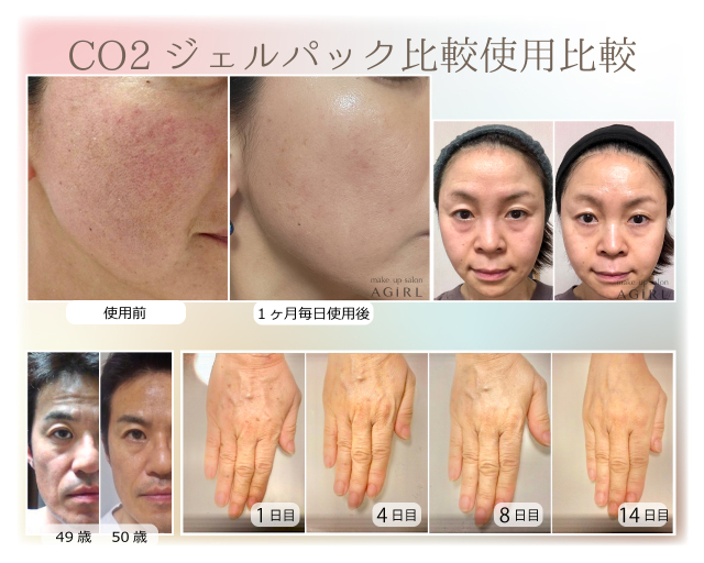 プリマトリーチェ 1817 CO2 ジェルパック10回分 (エコパック)