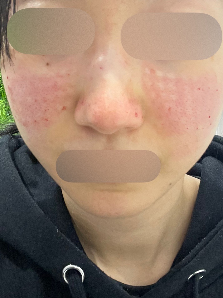 リジュラン 2cc | Karis Beauty Clinic