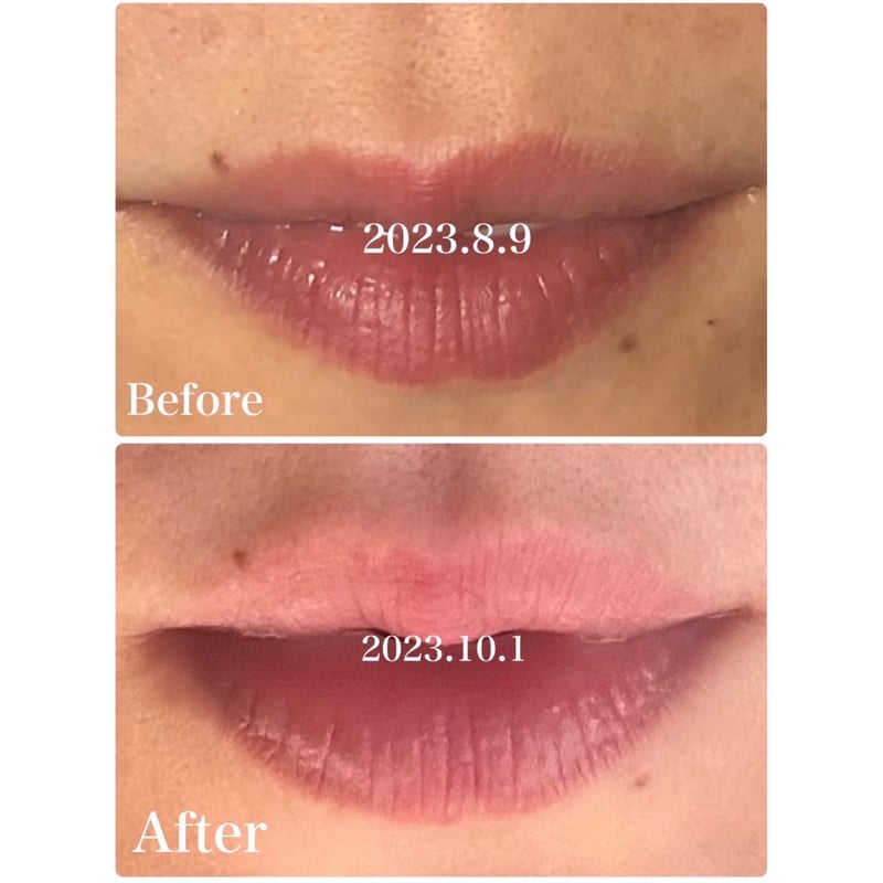 ダーマショットセラム 【正規取扱店】 | 【即日発送！】ダーマショット