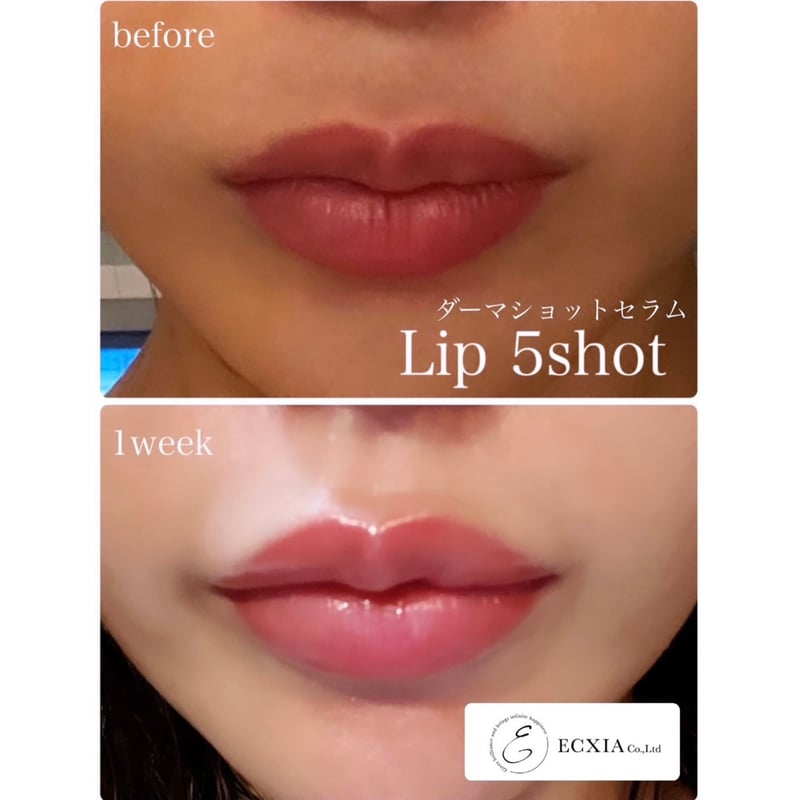 ダーマショットセラム 【正規取扱店】 | 【即日発送！】ダーマショット