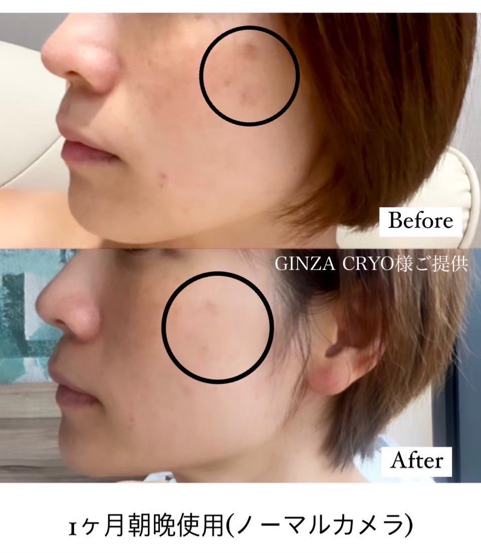 ダーマショットセラム 【正規取扱店】 | 【即日発送！】ダーマショット