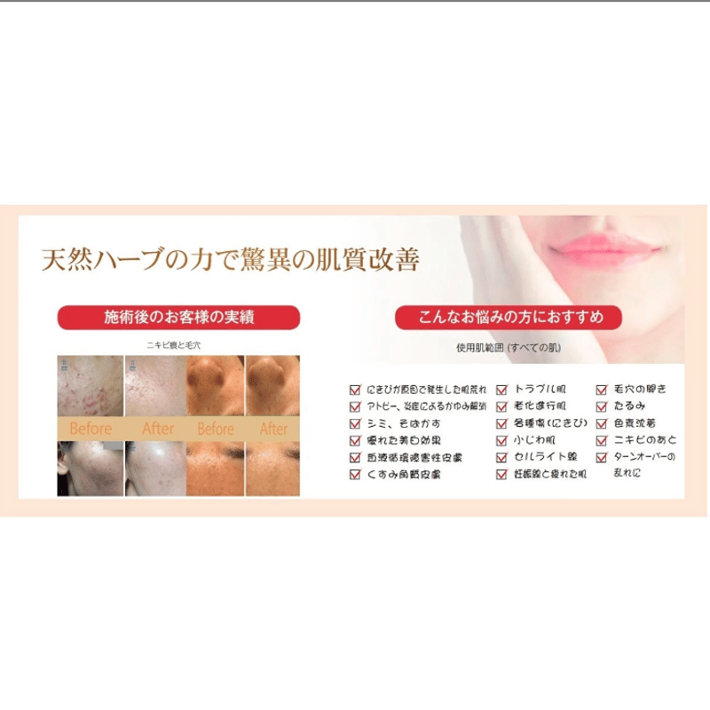 AMAROS O.H.L ハーブピーリングセット | SAVIAN