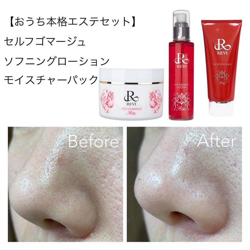 おうちで本格エステ】REVI おうちエステセット＋パックプレゼント付き
