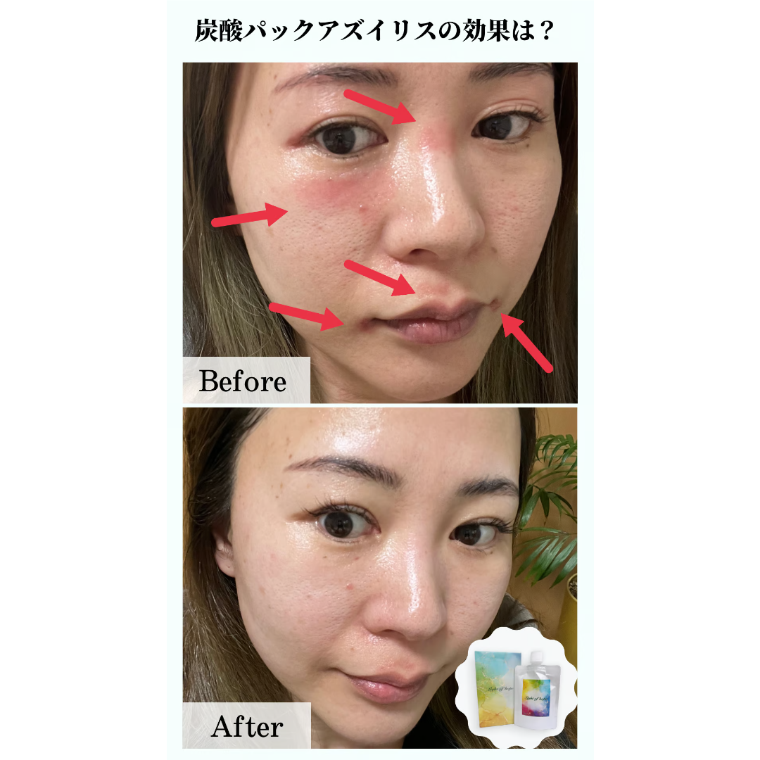 アズイリスミニ】(As_iris)炭酸ガスペーストパック | 【アズイリス正規
