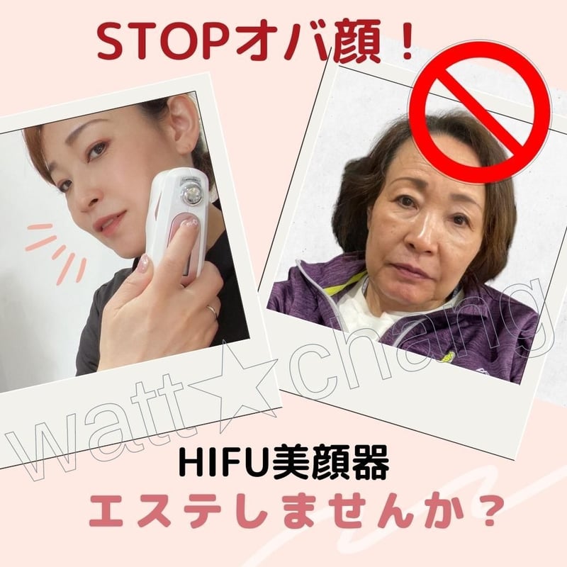 HIFU ハイフ 家庭用 美顔器 ジェル付 改善 対策 ウルセラ RF ラジオ波