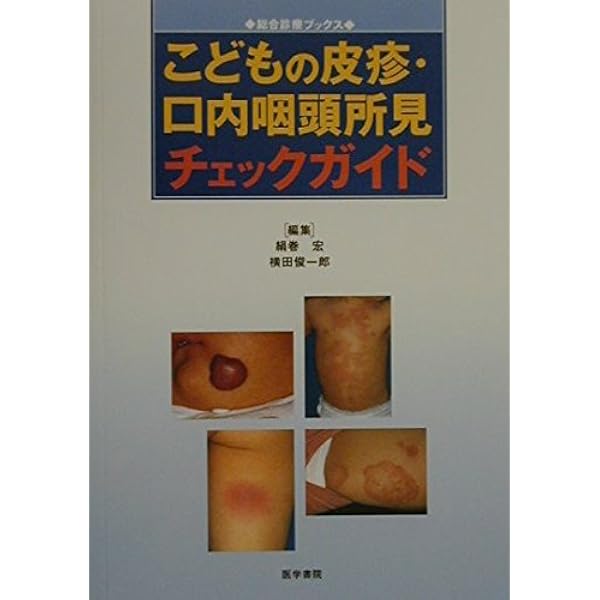 Amazon.co.jp: アトラスさくま: 小児咽頭所見 : 佐久間 孝久: 本