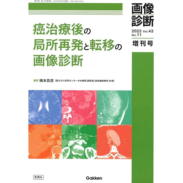画像診断 Vol.42 No.4 増刊号『画像による癌の病期診断2022』 | 楠本