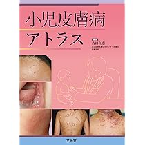 小児皮膚病アトラス | 吉田和恵 |本 | 通販 | Amazon