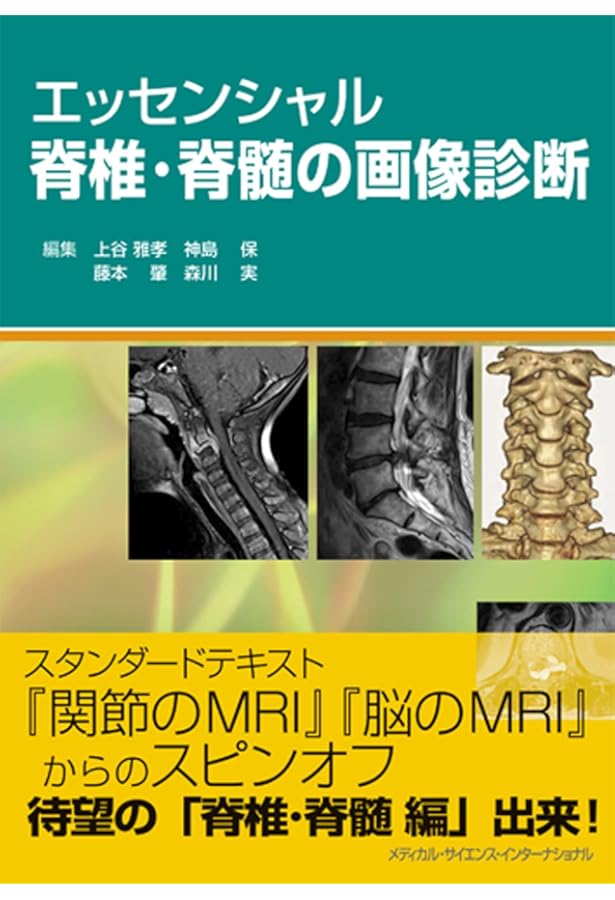 エキスパートのための脊椎脊髄疾患のMRI 第3版 | 柳下 章, 相田 典子