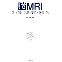 脳MRI 1.正常解剖 | 高橋 昭喜, 高橋 昭喜 |本 | 通販 | Amazon