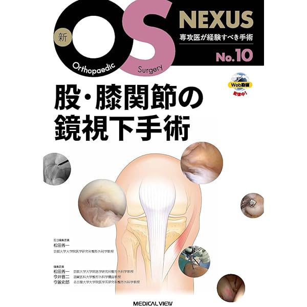 膝関節の再建手術 (新OS NEXUS No.1) | 松田 秀一 |本 | 通販 | Amazon
