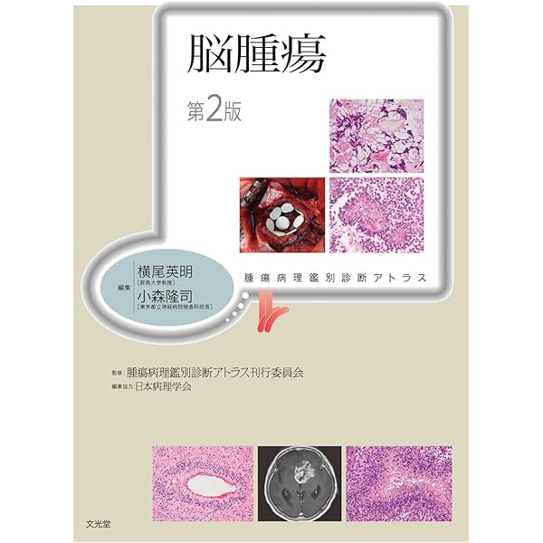 Amazon.co.jp: 脳腫瘍臨床病理カラーアトラス 第5版 : 日本脳腫瘍病理