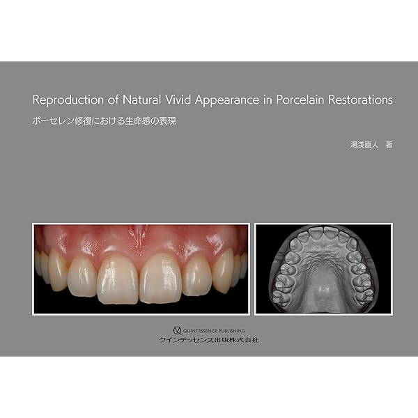 天然歯の形態学 2 | 脇田 太裕 |本 | 通販 | Amazon