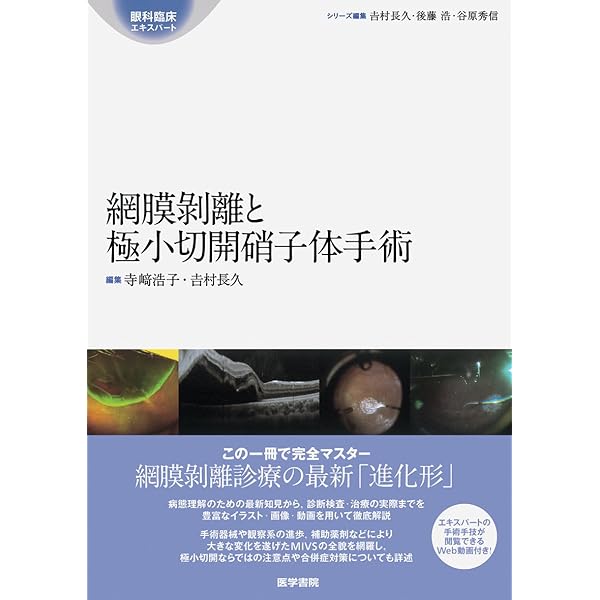 小切開硝子体手術 入門!−これだけわかれば始められる | 米田 一仁 |本