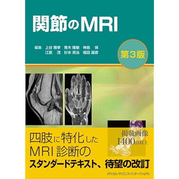 頭頸部のCT・MRI 第3版 | 尾尻博也, 酒井 修 |本 | 通販 | Amazon
