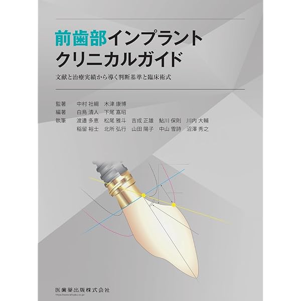 シングル・トゥースインプラント: 前歯部および臼歯部抜歯窩に対する低