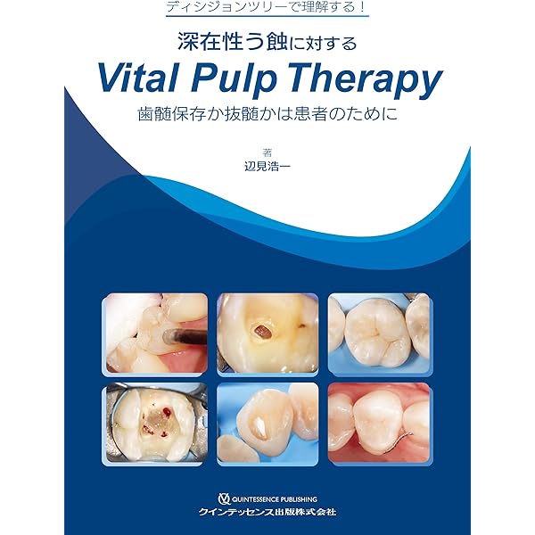 治る歯髄 治らない歯髄 | 泉 英之 |本 | 通販 | Amazon