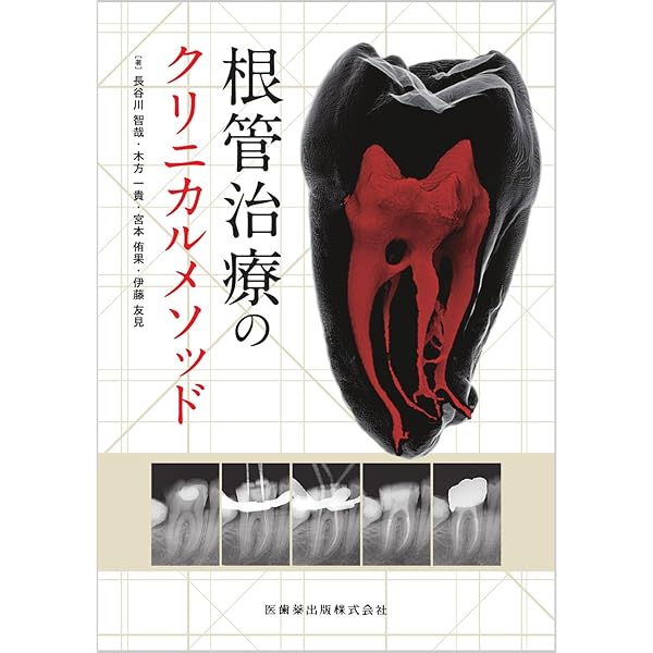 完全解説 根管治療トラブル攻略本: エンドのよくある24の難局面大攻略