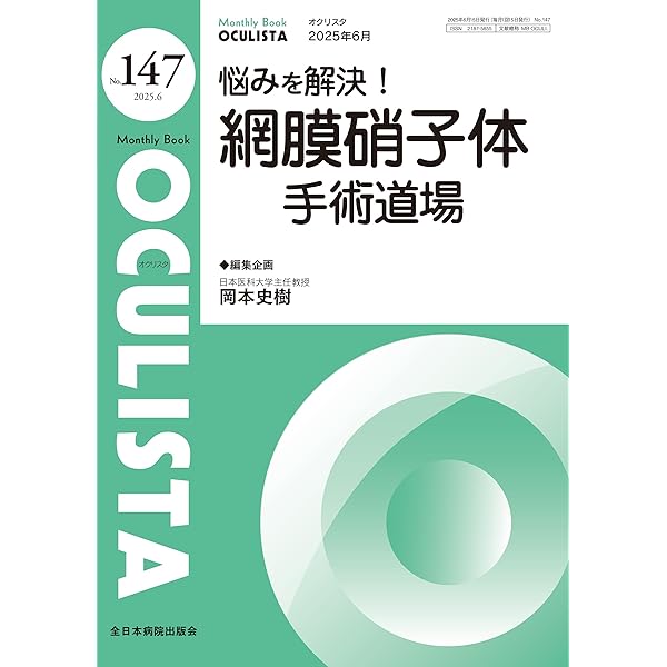 小切開硝子体手術 入門!−これだけわかれば始められる | 米田 一仁 |本
